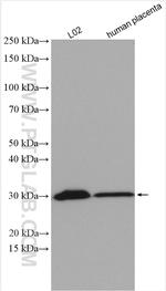 SLC25A6 Antibody in Western Blot (WB)