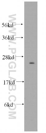 Connexin-26 Antibody in Western Blot (WB)