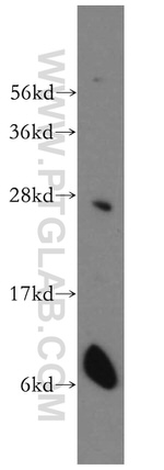 Connexin-26 Antibody in Western Blot (WB)