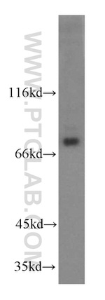 CUL4A Antibody in Western Blot (WB)