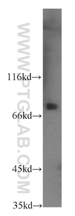 CUL4A Antibody in Western Blot (WB)