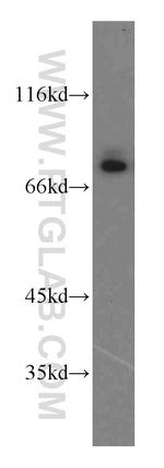 CUL4A Antibody in Western Blot (WB)
