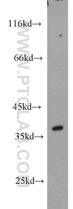 HSD17B7 Antibody in Western Blot (WB)