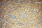 SYK Antibody in Immunohistochemistry (Paraffin) (IHC (P))