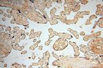 SYK Antibody in Immunohistochemistry (Paraffin) (IHC (P))