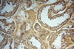 SYK Antibody in Immunohistochemistry (Paraffin) (IHC (P))