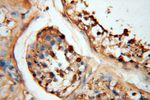 SYK Antibody in Immunohistochemistry (Paraffin) (IHC (P))