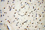 SYK Antibody in Immunohistochemistry (Paraffin) (IHC (P))