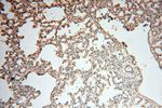 SYK Antibody in Immunohistochemistry (Paraffin) (IHC (P))