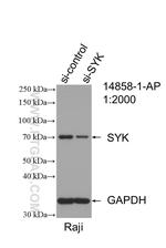 SYK Antibody in Western Blot (WB)