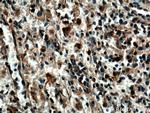 SYK Antibody in Immunohistochemistry (Paraffin) (IHC (P))