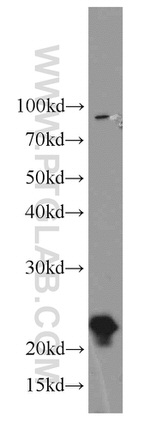 LMP7 Antibody in Western Blot (WB)