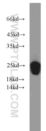 LMP7 Antibody in Western Blot (WB)