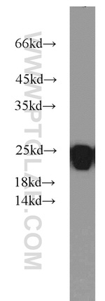 LMP7 Antibody in Western Blot (WB)