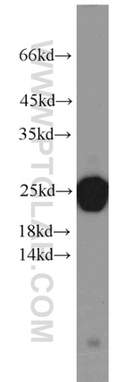 LMP7 Antibody in Western Blot (WB)