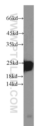 LMP7 Antibody in Western Blot (WB)