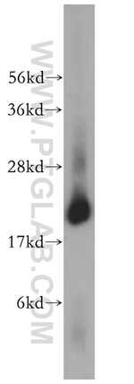 LMP7 Antibody in Western Blot (WB)