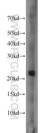 LMP7 Antibody in Western Blot (WB)