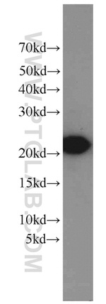 LMP7 Antibody in Western Blot (WB)