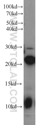 LMP7 Antibody in Western Blot (WB)