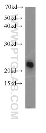 LMP7 Antibody in Western Blot (WB)