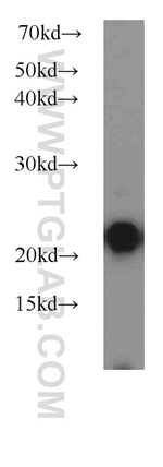 LMP7 Antibody in Western Blot (WB)