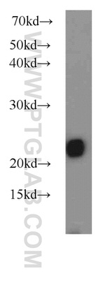 LMP7 Antibody in Western Blot (WB)