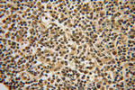 LMP7 Antibody in Immunohistochemistry (Paraffin) (IHC (P))