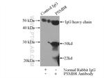 LMP7 Antibody in Immunoprecipitation (IP)