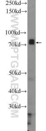 THOC5 Antibody in Western Blot (WB)