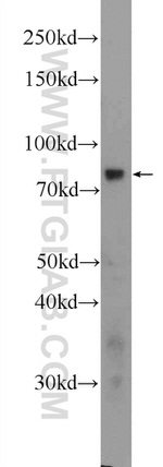 THOC5 Antibody in Western Blot (WB)