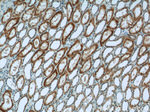 SDHA Antibody in Immunohistochemistry (Paraffin) (IHC (P))