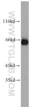 SDHA Antibody in Western Blot (WB)