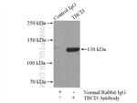 TBCD Antibody in Immunoprecipitation (IP)