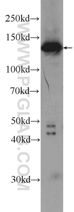 TBCD Antibody in Western Blot (WB)