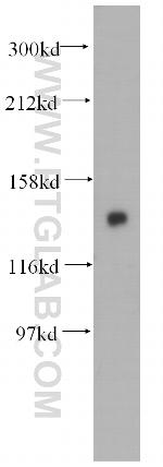 TBCD Antibody in Western Blot (WB)