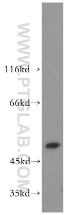 PPOX Antibody in Western Blot (WB)