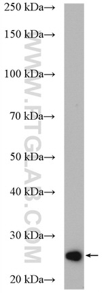 SPCS2 Antibody in Western Blot (WB)