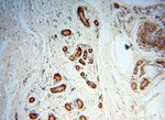 POLM Antibody in Immunohistochemistry (Paraffin) (IHC (P))