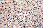 POLM Antibody in Immunohistochemistry (Paraffin) (IHC (P))