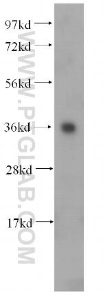 COQ9 Antibody in Western Blot (WB)