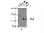 DAAM1 Antibody in Immunoprecipitation (IP)