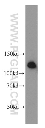 DAAM1 Antibody in Western Blot (WB)