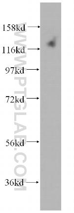 DAAM1 Antibody in Western Blot (WB)