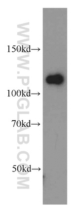 DAAM1 Antibody in Western Blot (WB)