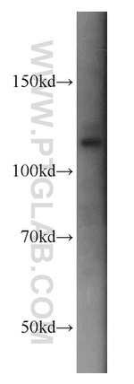 DAAM1 Antibody in Western Blot (WB)