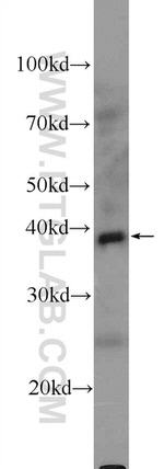 DHODH Antibody in Western Blot (WB)