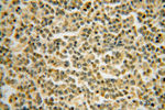 BTG1 Antibody in Immunohistochemistry (Paraffin) (IHC (P))