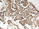 BTG1 Antibody in Immunohistochemistry (Paraffin) (IHC (P))