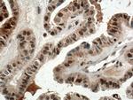 BTG1 Antibody in Immunohistochemistry (Paraffin) (IHC (P))